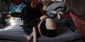 المأساة تشتد والجوع ينهش أجساد أطفال غزة