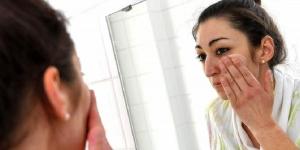 الطفح الجلدي على الوجه.. متى يكون علامة خطر؟