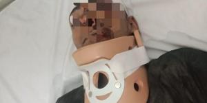 صحة الدقهلية: نجاح جراحة دقيقة لإصلاح كسر بالرقبة في تمى الأمديد