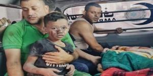 الأمم المتحدة تعلن وفاة أكثر من 100 طفل فى غزة بسبب "التجويع"