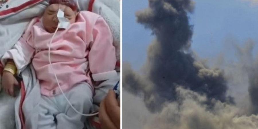 ولادة طفلة "بلا دماغ" مع تزايد ظاهرة "تشوه الأجنة" في قطاع غزة