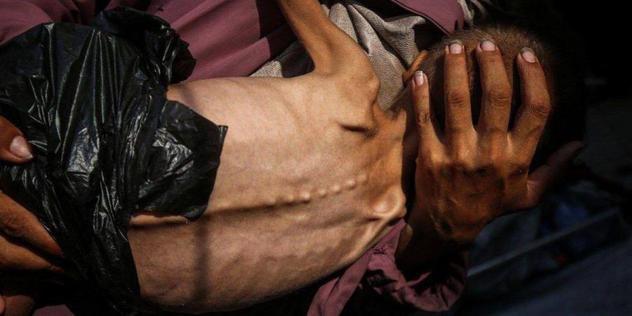 استشهاد طفل فلسطيني في خانيونس بغزة نتيجة حرب التجويع الإسرائيلية